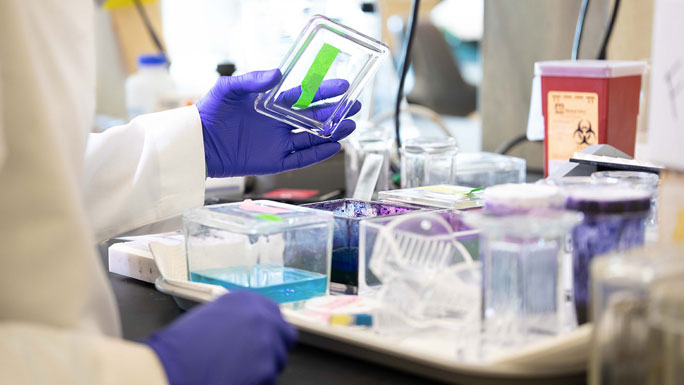 gloved hands holding top of container in cancer lab