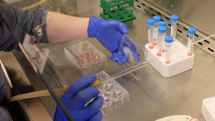 prostate cancer research lab
