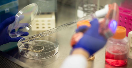 cancer research lab long pipette and petri dish