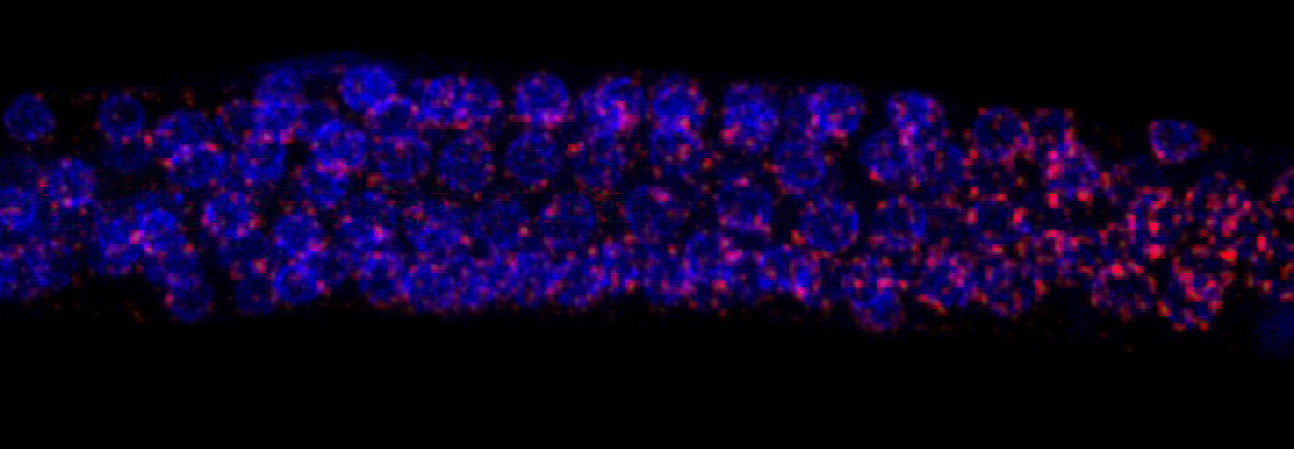 Germ line cells of C. elegans showing PIWI and piRNAs