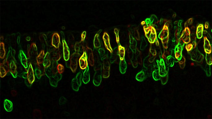 Noncoding DNA