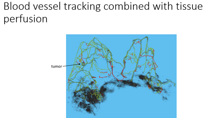 Blood vessel tracking combined with tissue perfusion in ultrafast abbreviated MRI