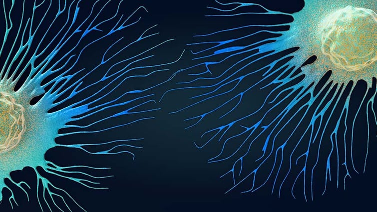 spreading cancer cells