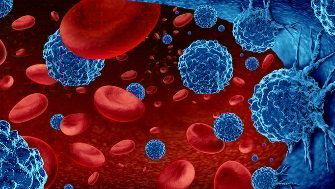 Cancer in the blood outbreak and treatment for malignant cells in a human body caused by carcinogens and genetics with a cancerous cell as an immunotherapy and leukemia or lymphoma symbol and medical therapy as a 3D render.