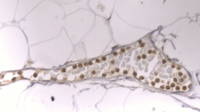 neutrophils