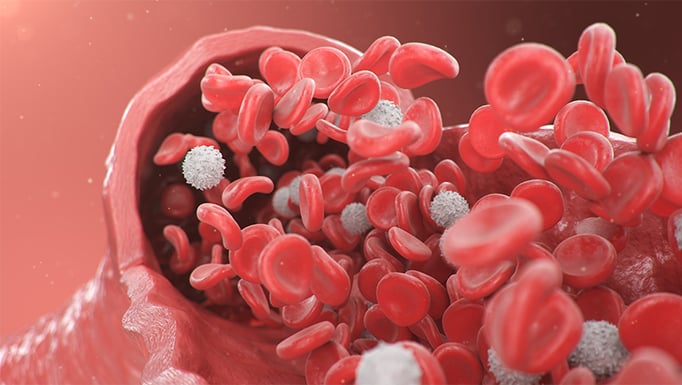 aortic aneurysm resection priority assessment