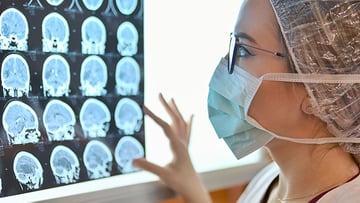 Young Female Doctor Examine Mri Picture