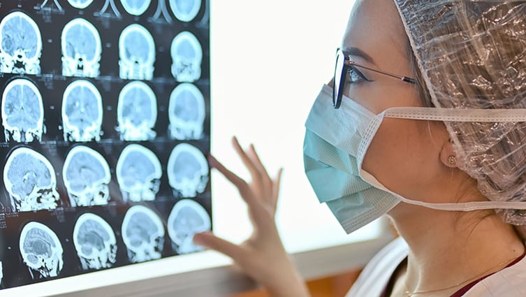 Young Female Doctor Examine Mri Picture