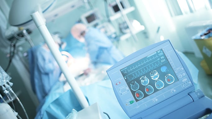 A screen in an operating room displaying a brain scan.