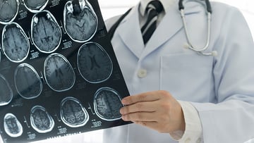 Doctor check up x-ray film of the brain by mri or ct scan brain at patient room hospital.
