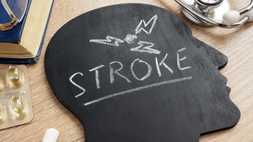 Disease Stroke written on a head shape.