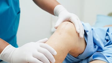 Knee replacement
