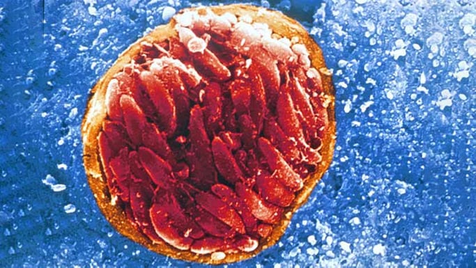 Toxoplasmosis gondii