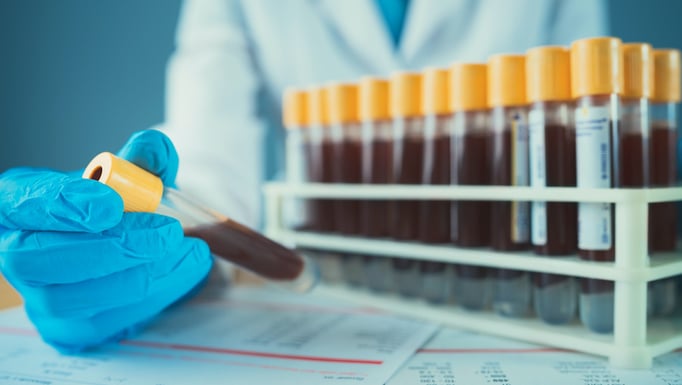 testing vials