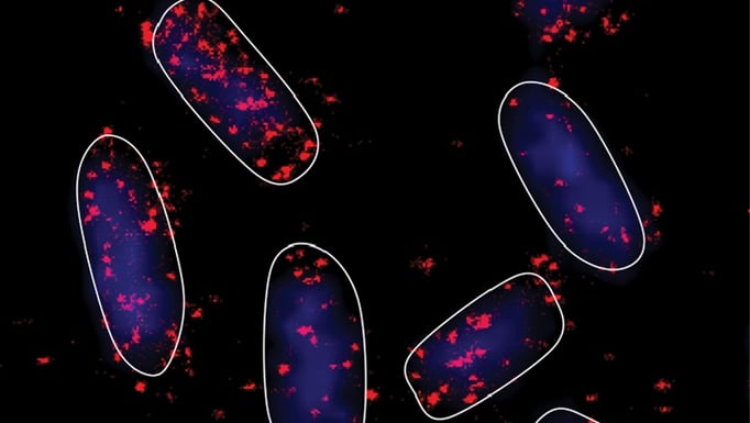 ecoli