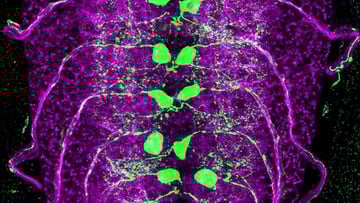 A fruit fly larval spinal cord.