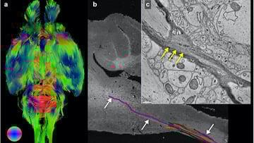 By using an imaging pipeline of MRI, µCT, and EM, Foxley, Kasthuri, and their team were able to simultaneously resolve brain structures, like the white matter, at (a) macro-, (b) meso-, and (c) microscopic-scales in the same brain. Image from Foxley et al.