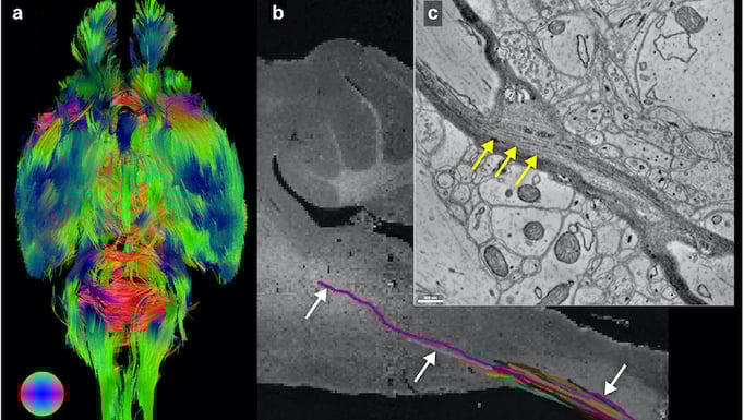 By using an imaging pipeline of MRI, µCT, and EM, Foxley, Kasthuri, and their team were able to simultaneously resolve brain structures, like the white matter, at (a) macro-, (b) meso-, and (c) microscopic-scales in the same brain. Image from Foxley et al.