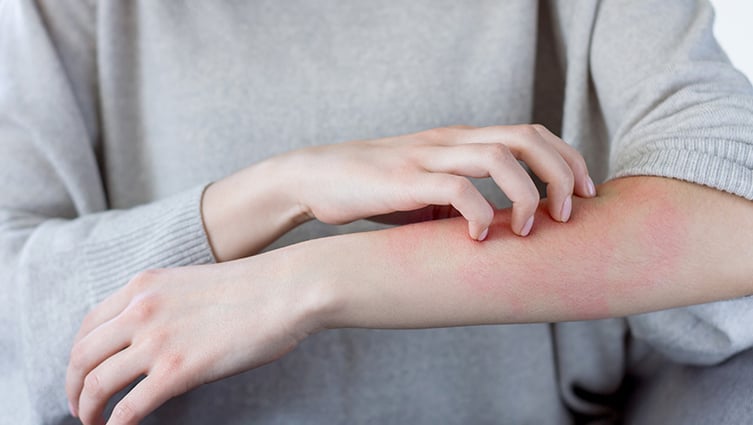 A woman picking her skin