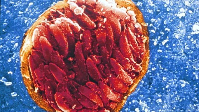 Toxoplasma gondii is endemic throughout the world, present in the brain of an estimated 2 billion people.
