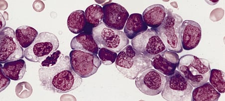 AML cells