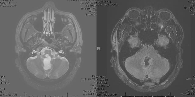 Balogun CT scan
