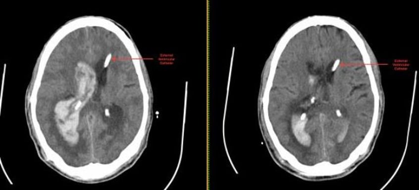 Brain Scan