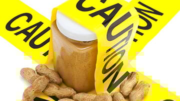 peanut allergies