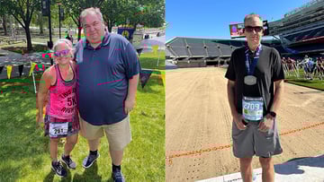 Duodenal switch surgery patient Matt Wingard before and after pics