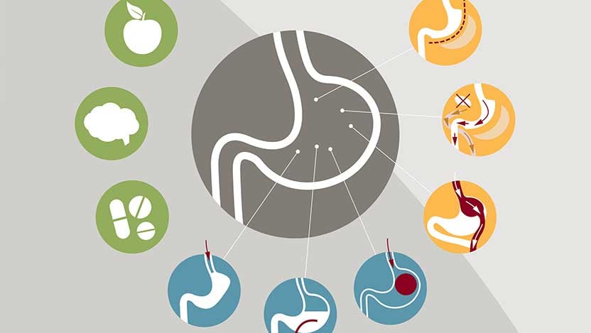 Preview of medical weight loss infographic