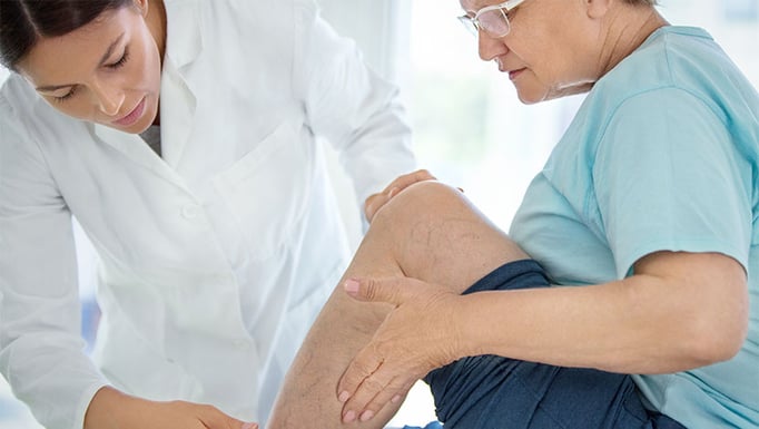 Expert advice on varicose vein prevention and treatment - UChicago