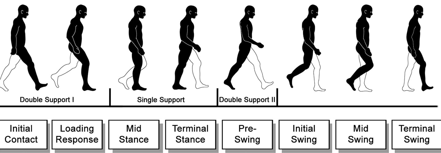 Why do so many older people limp? - UChicago Medicine