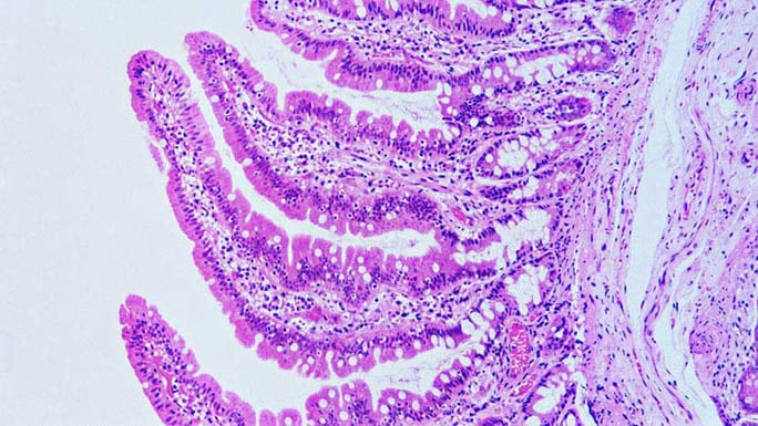 Intestinal villi