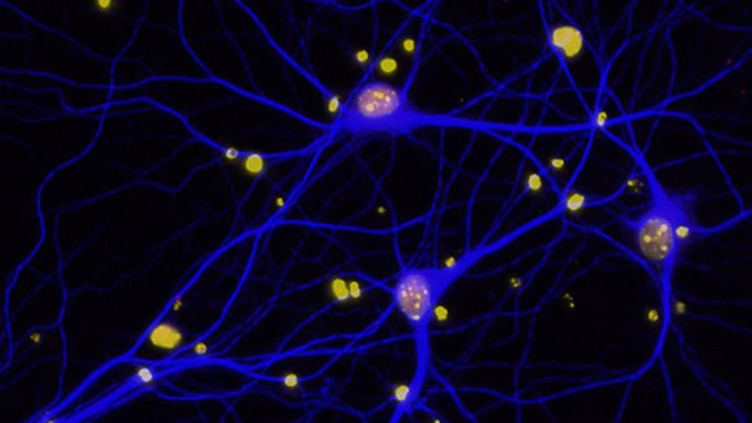 Neurons in the brain of a mouse with Alzheimer