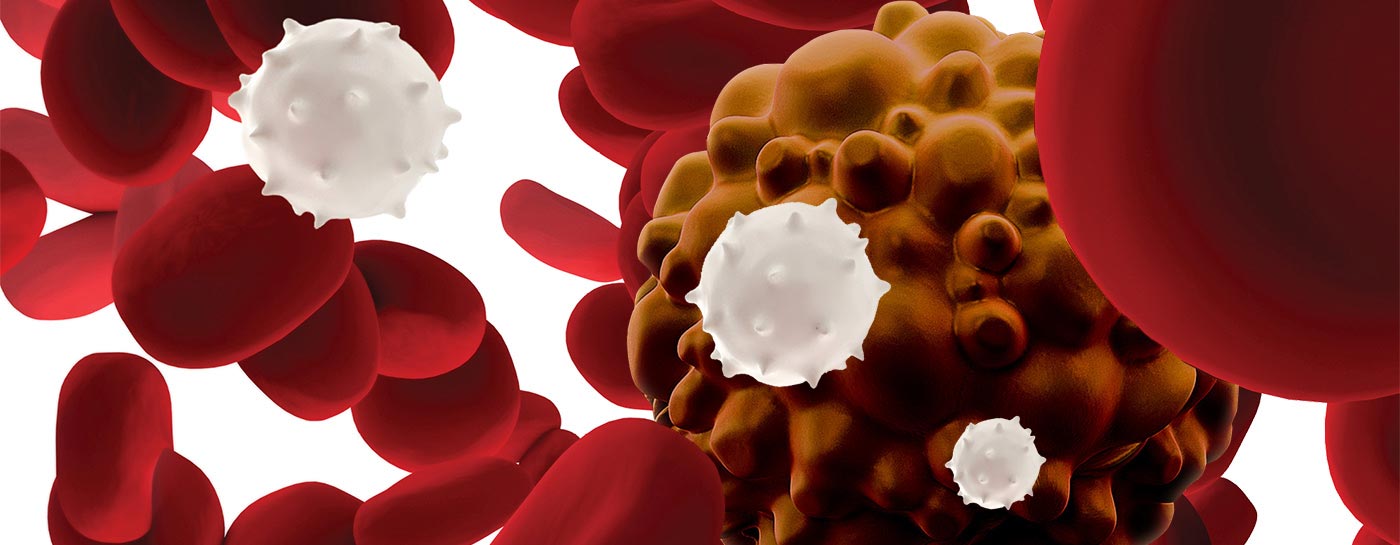 CAR T-cell therapy is a worldwide cancer breakthrough. And UChicago Medicine is the first to offer it in Chicago.