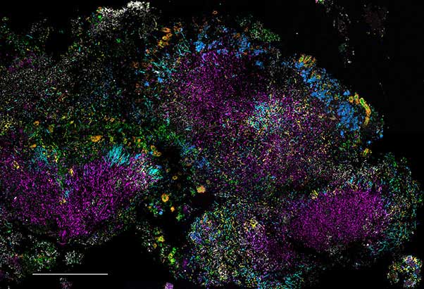 Dental microbiome