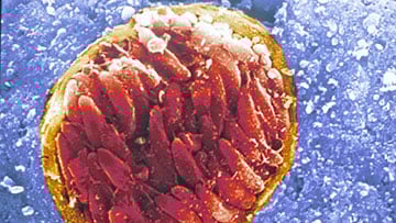 The protozoan Toxoplasma gondii, tissue cyst in brain