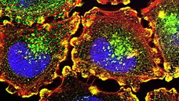 Cancer cells