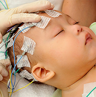 Early Detection Of Seizures In Infants Crucial To Brain Development Uchicago Medicine