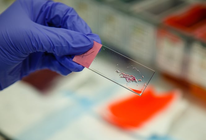 How pathologists diagnose disease and find treatments - UChicago Medicine
