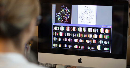 karotype on computer screen