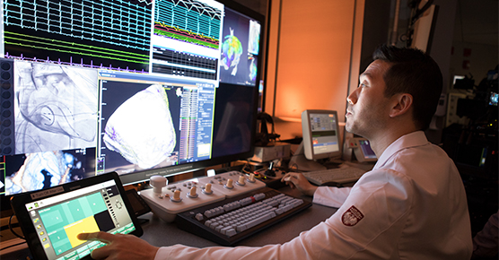Afib multi Tung 556 x 290