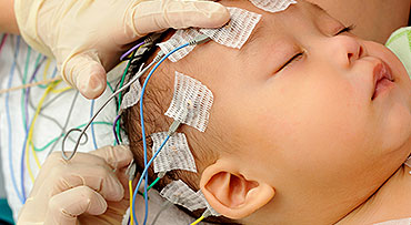 Gloved hands placing EEG electrodes on sleeping baby