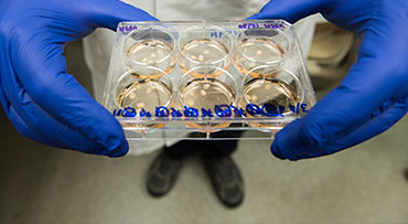 Two hands holding test items in a diabetes research lab