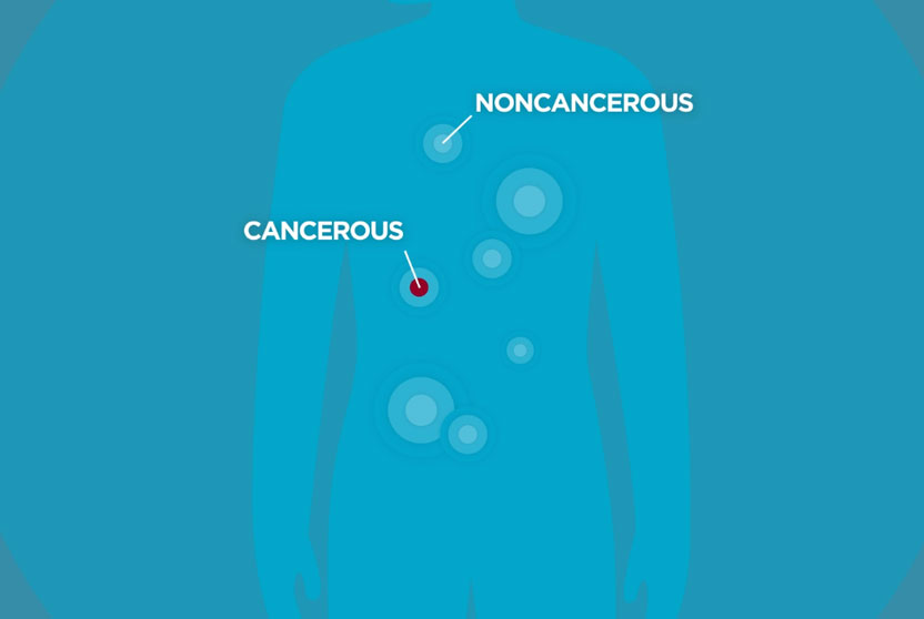 Theranostics animation image, showing cancer cells and healthy cells