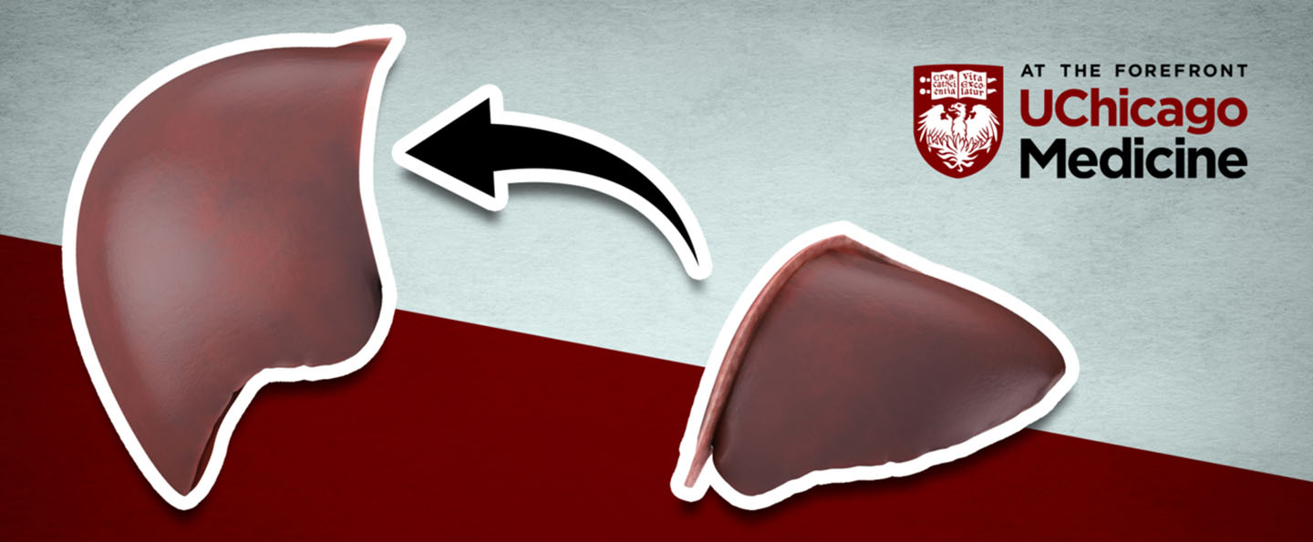 Living donor liver transplant informational video