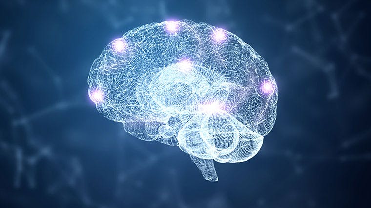 Image of brain with epilepsy