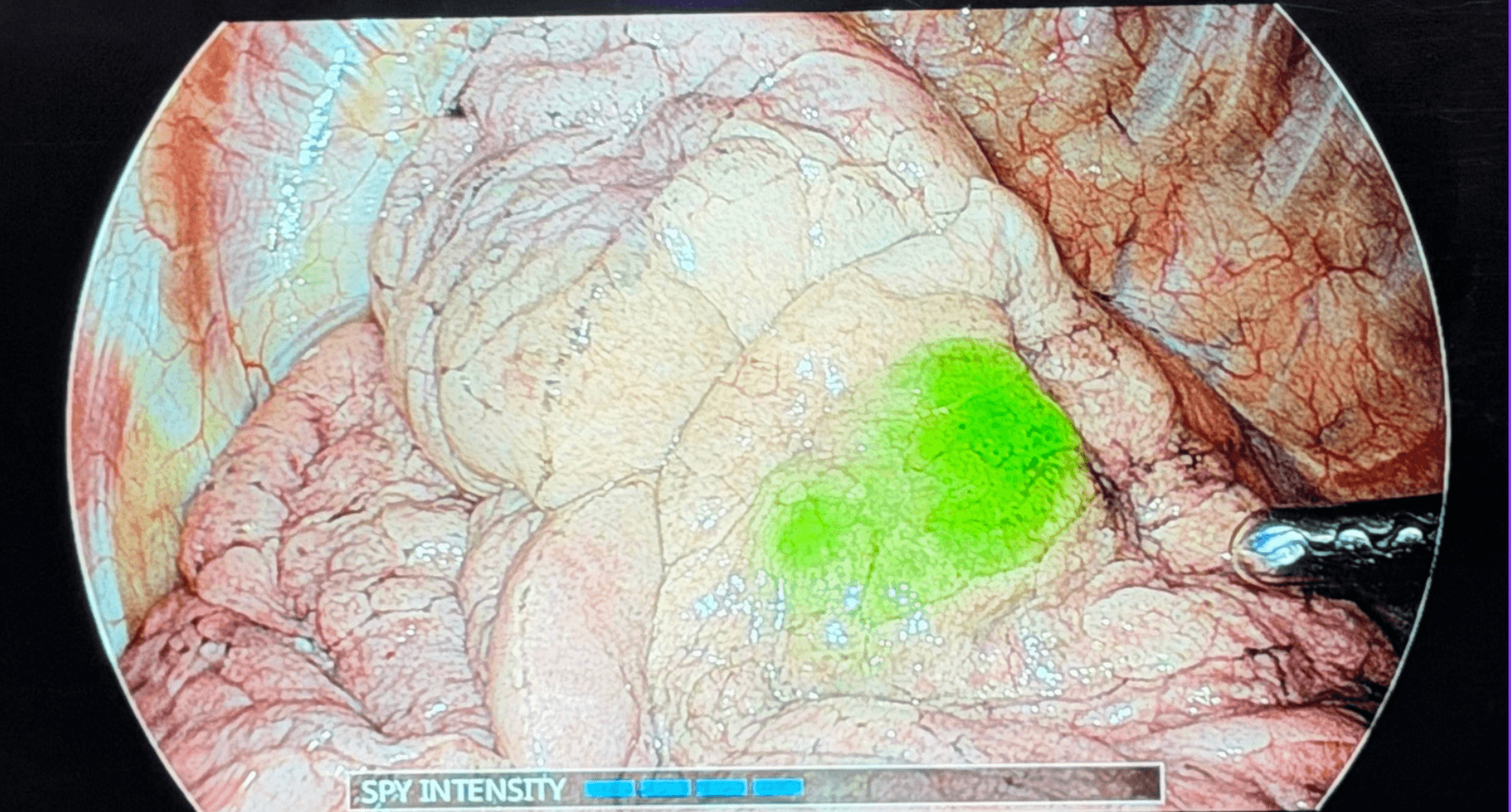 Lung photos courtesy of Cytalux