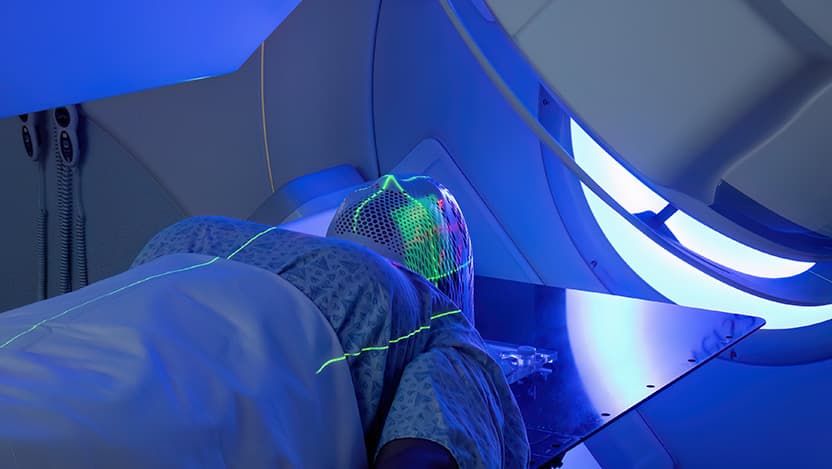 breast cancer radiation therapy new research