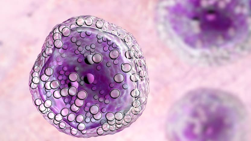 Burkitt's lymphoma cells, stock photo